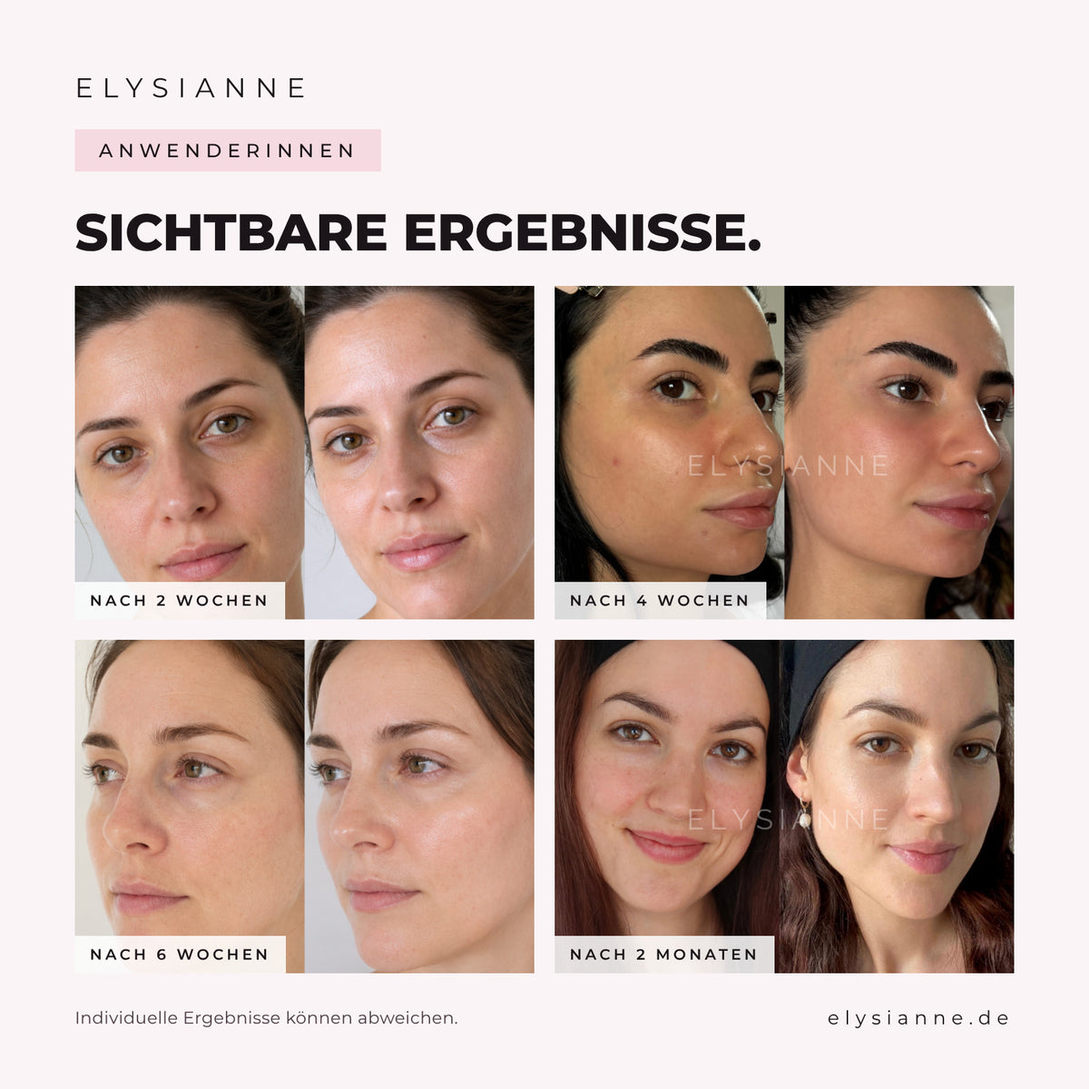 Elysianne Ultra-E Glow Wand