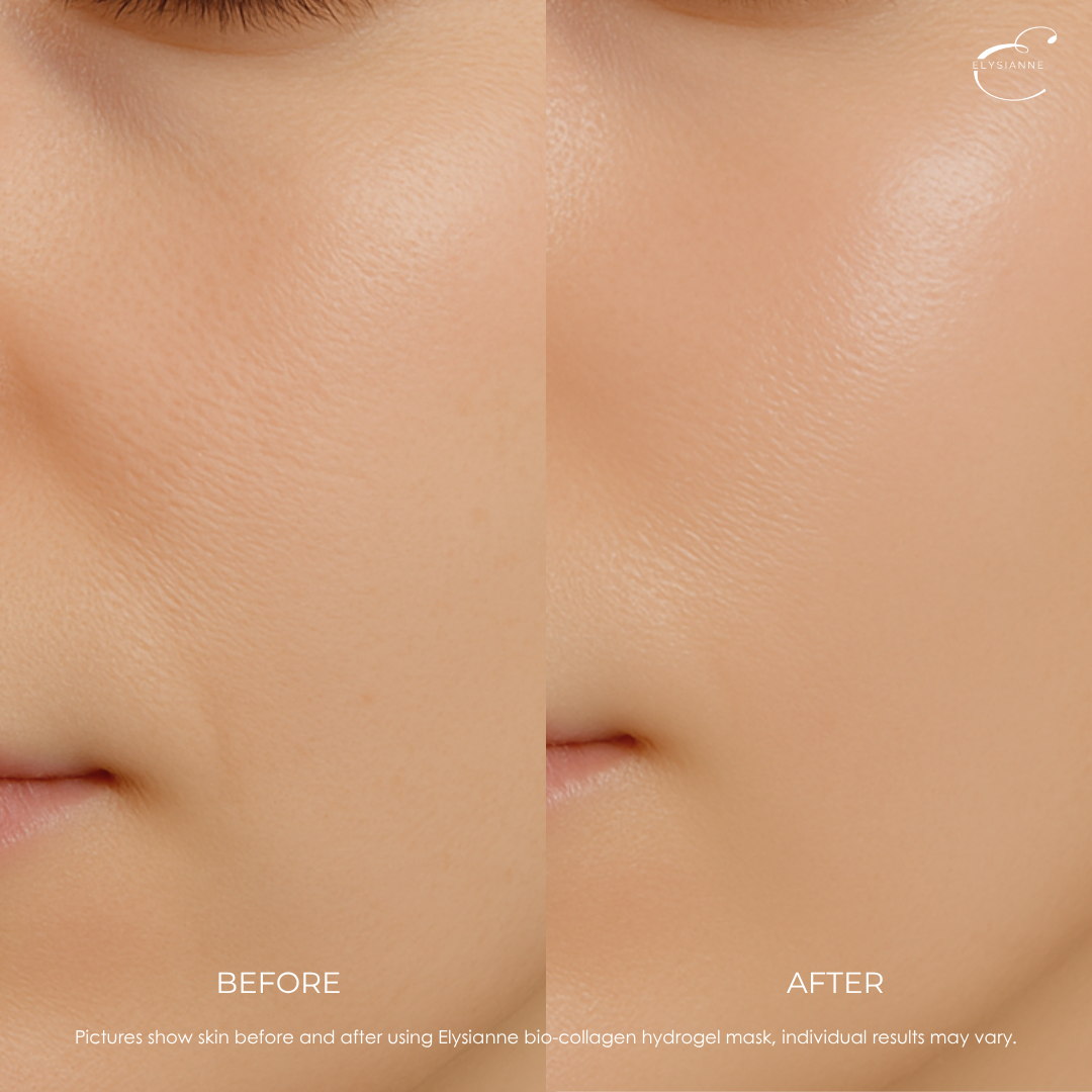 Bio-Collagen Hydrogel Mask