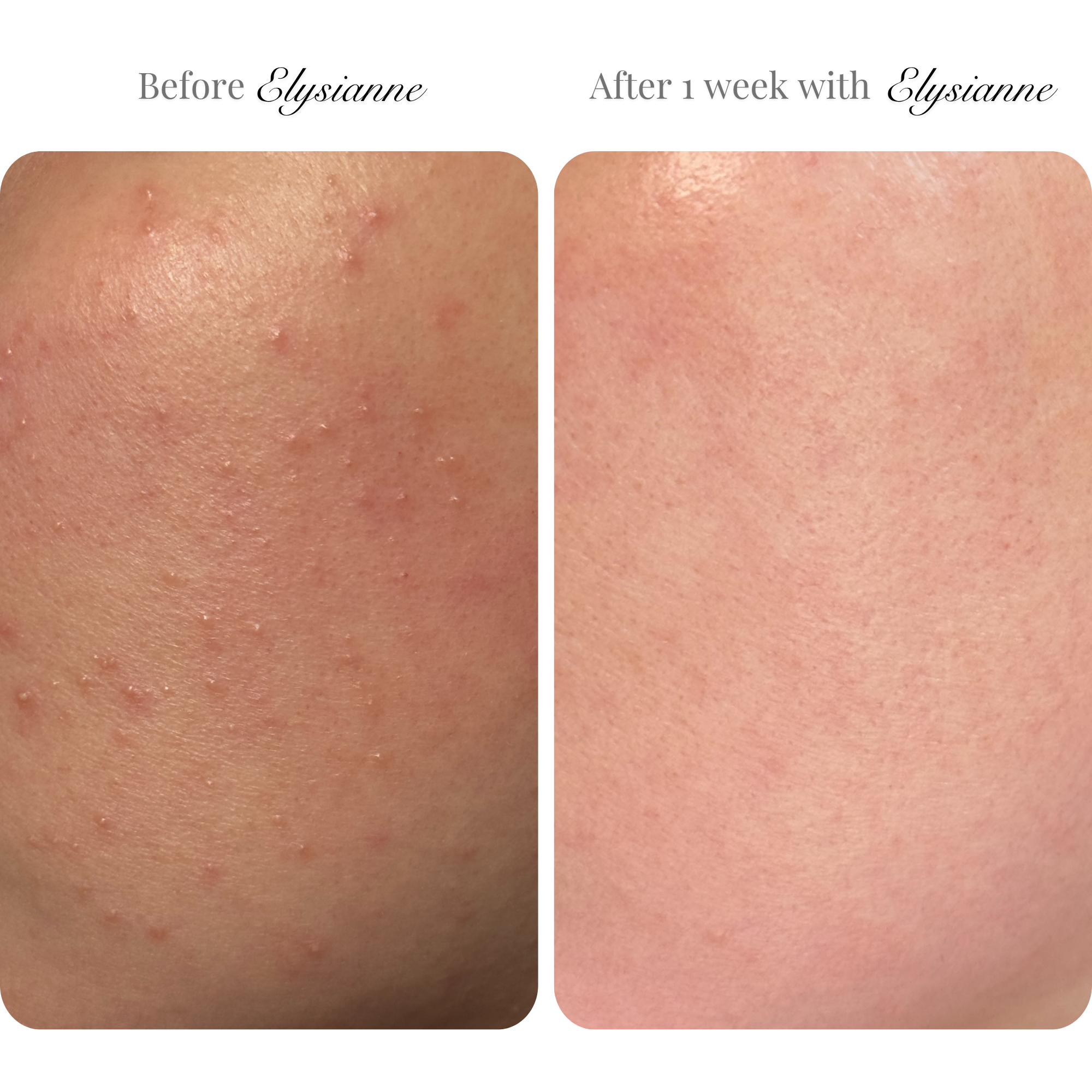 Lumière Visage™ LED Sculpting Mask