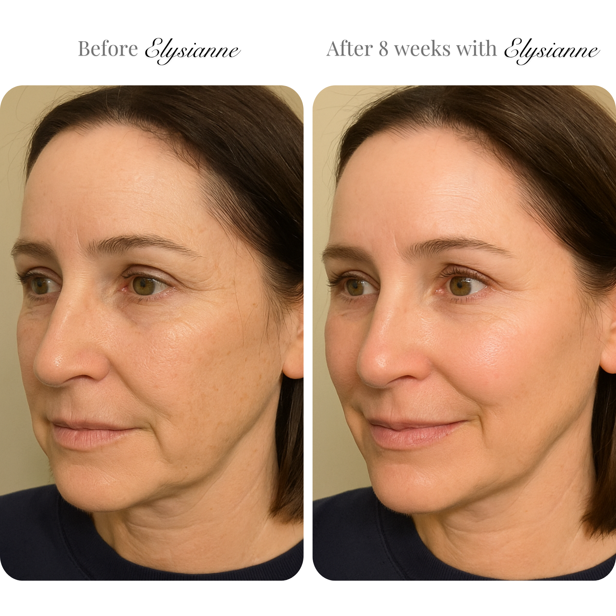Lumière Visage™ LED Sculpting Mask