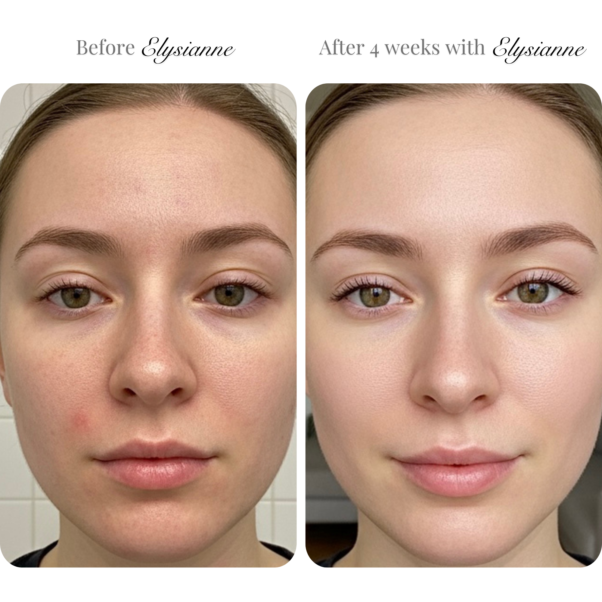 Lumière Visage LED Sculpting Mask