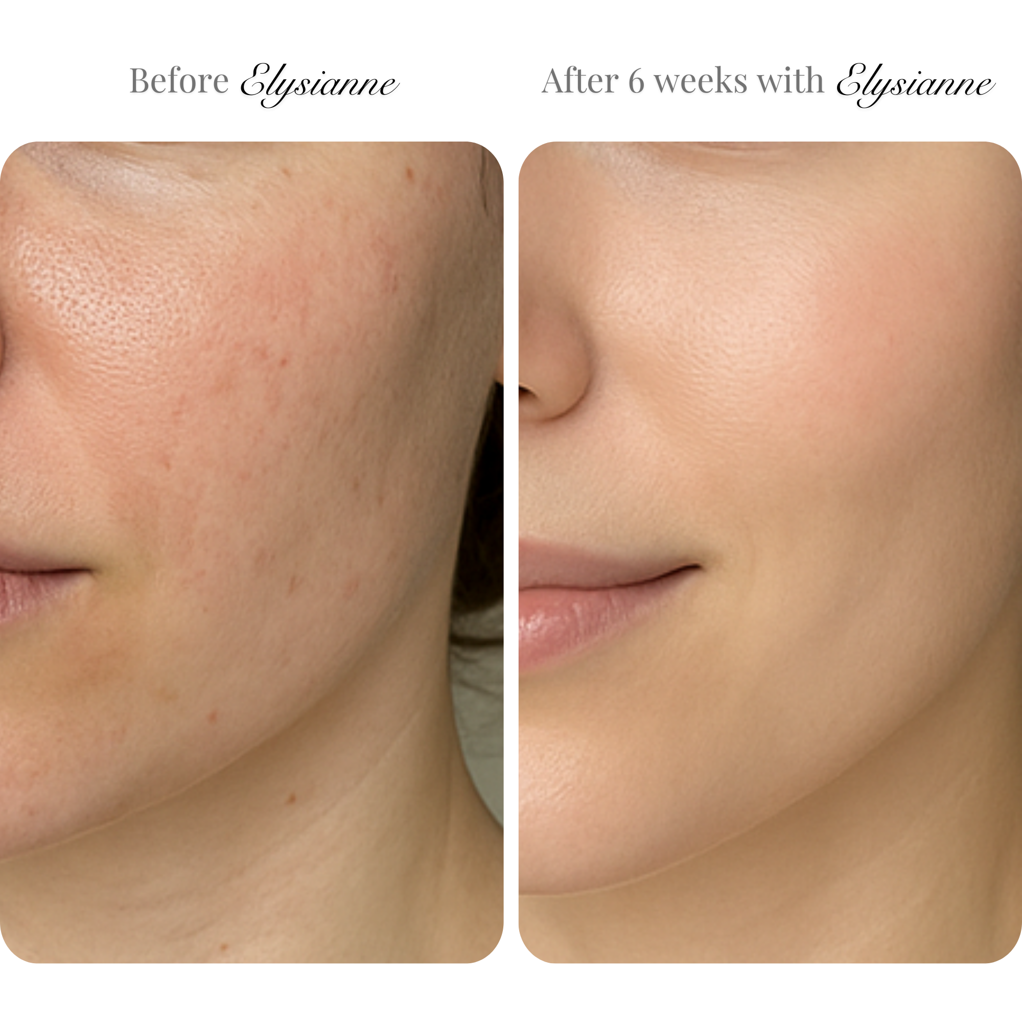 Lumière Visage LED Sculpting Mask