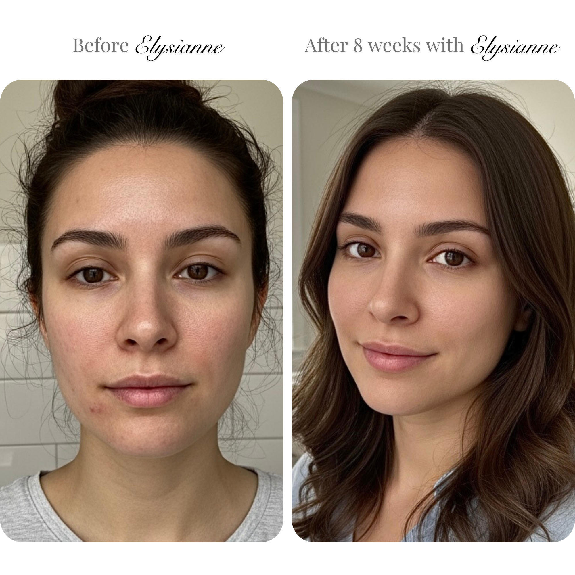 Lumière Visage LED Sculpting Mask