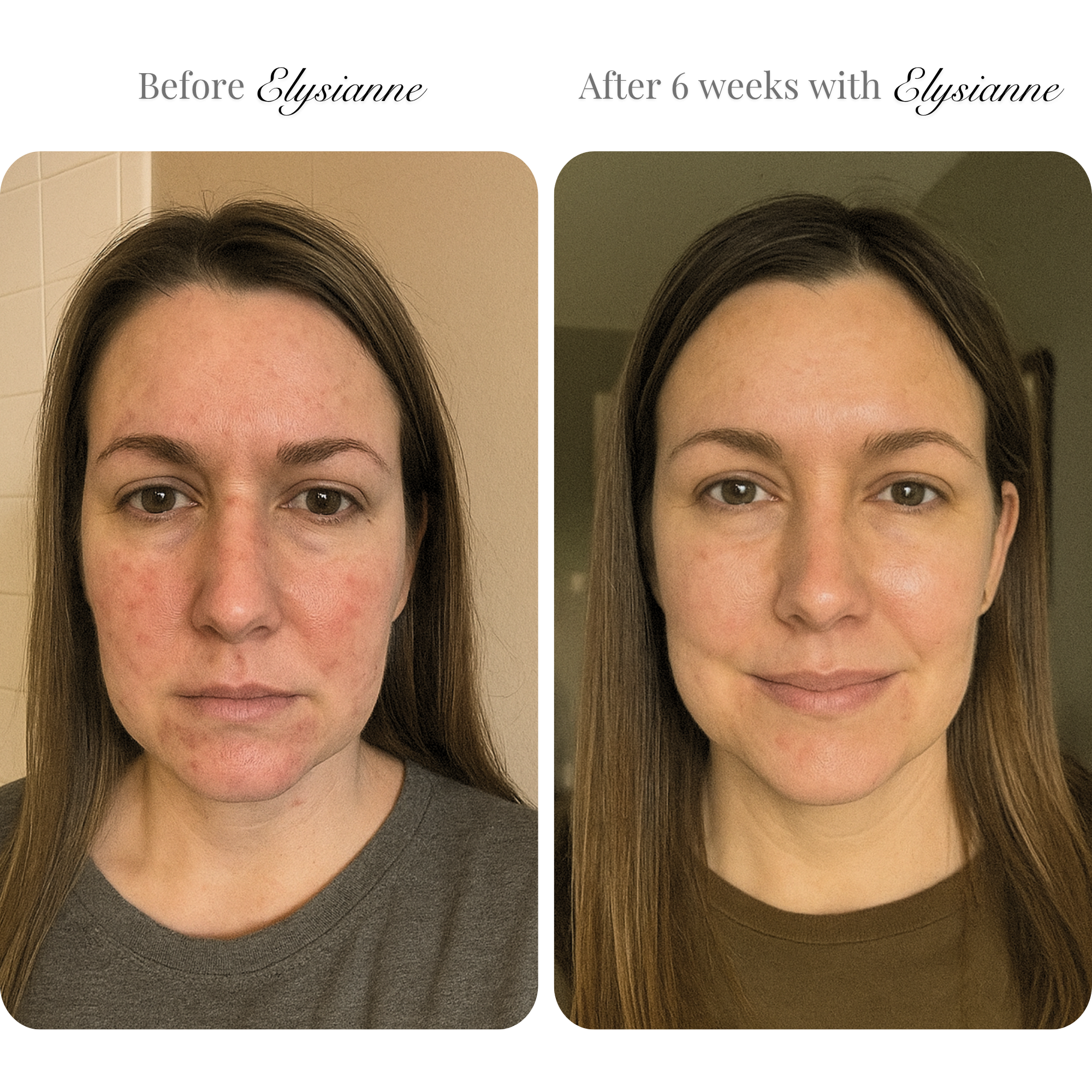 Lumière Visage™ LED Sculpting Mask
