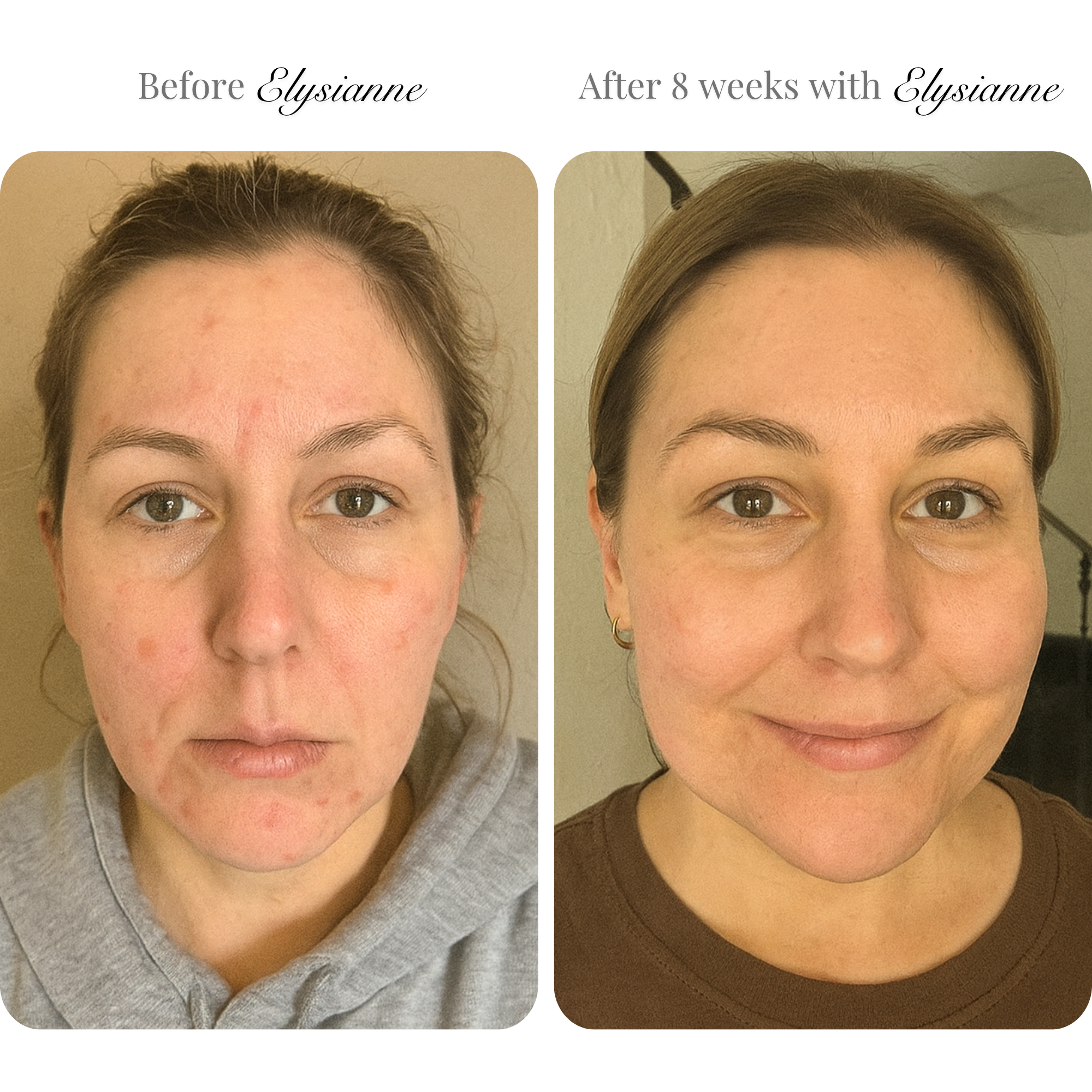 Lumière Visage™ LED Sculpting Mask