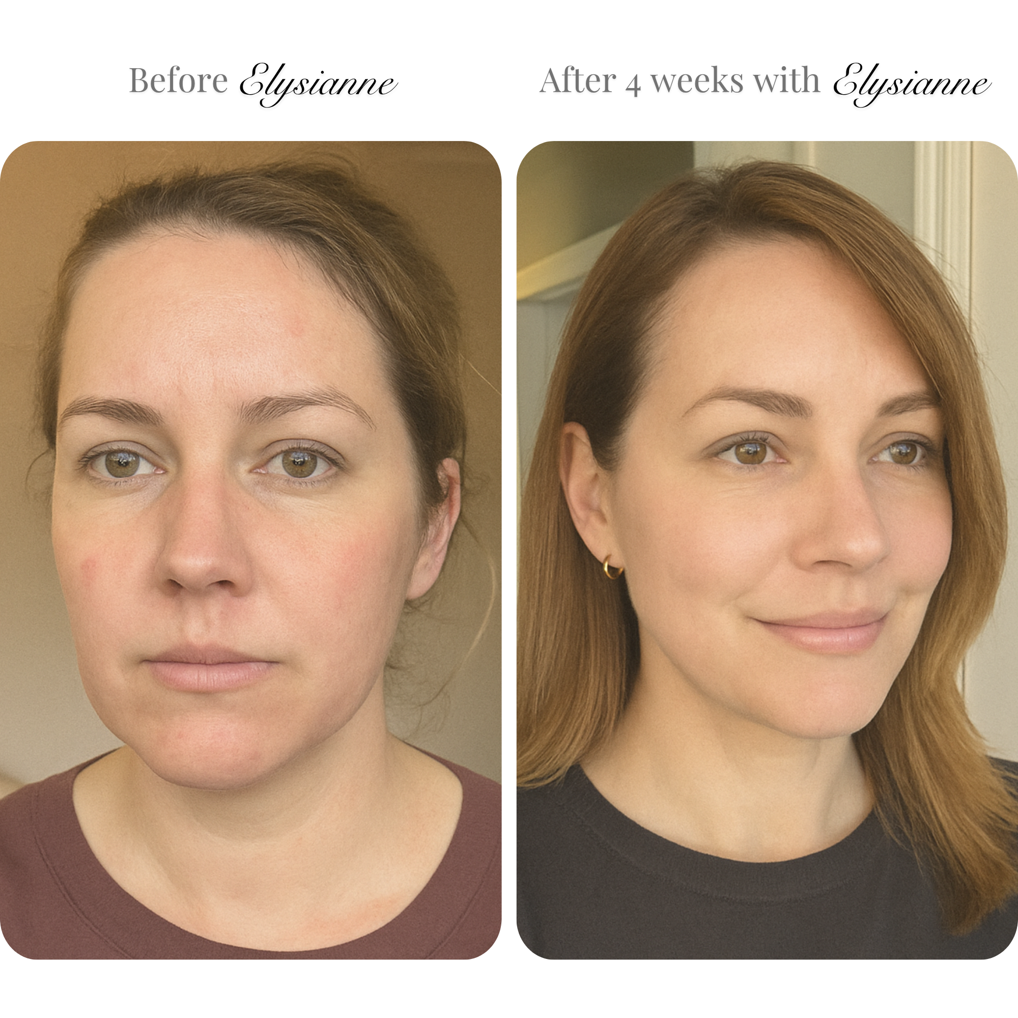 Lumière Visage™ LED Sculpting Mask