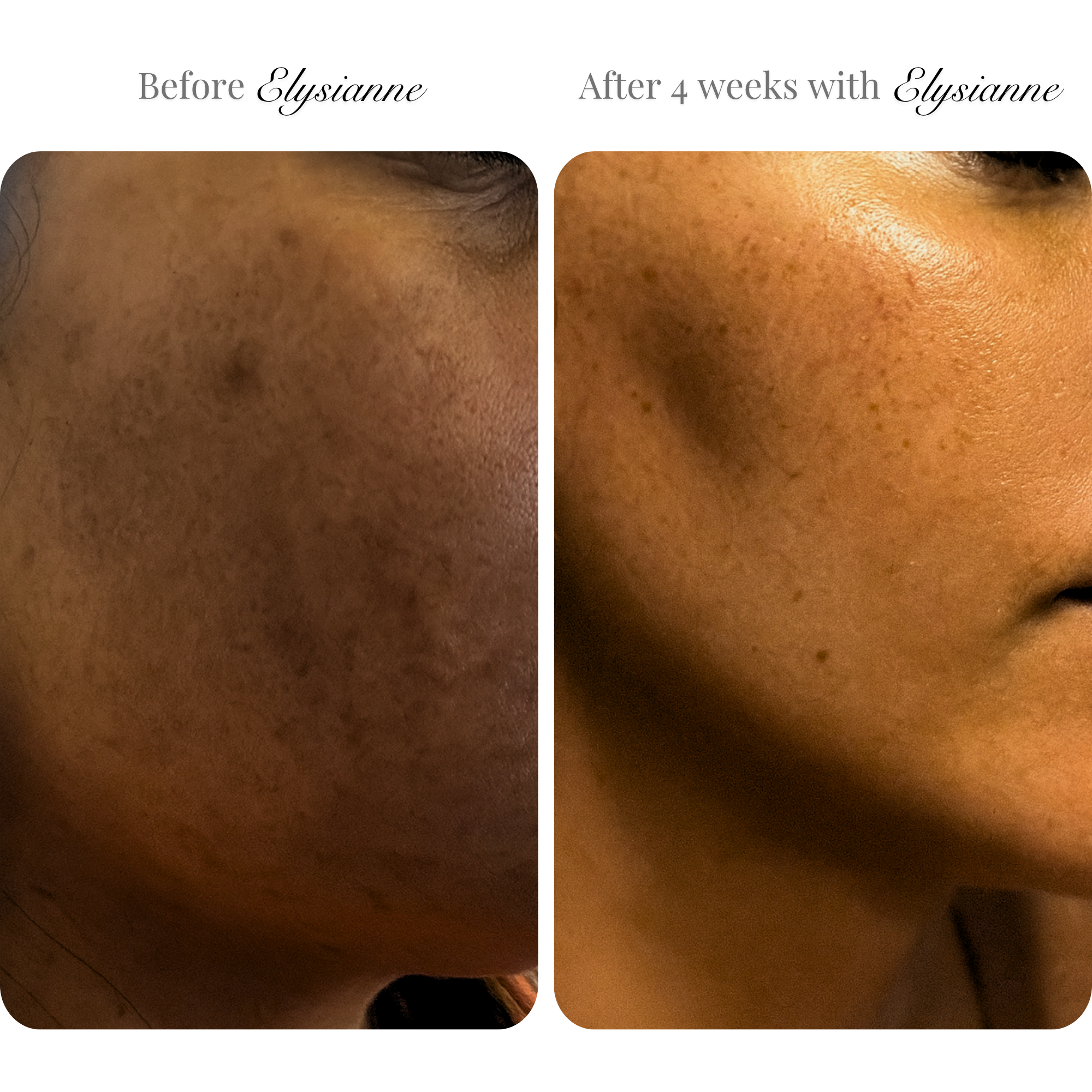Lumière Visage™ LED Sculpting Mask