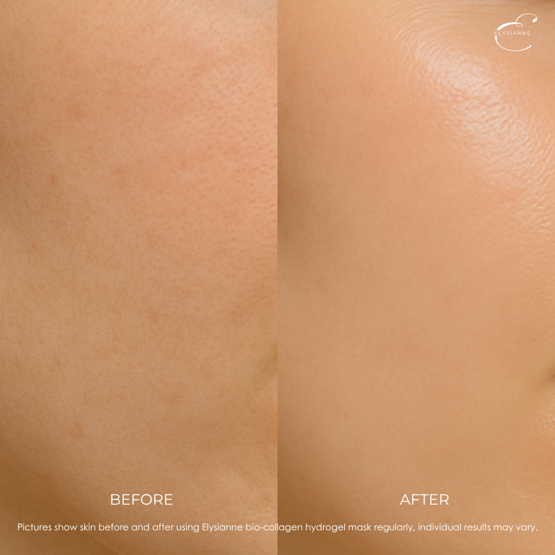 Bio-Collagen Hydrogel Mask