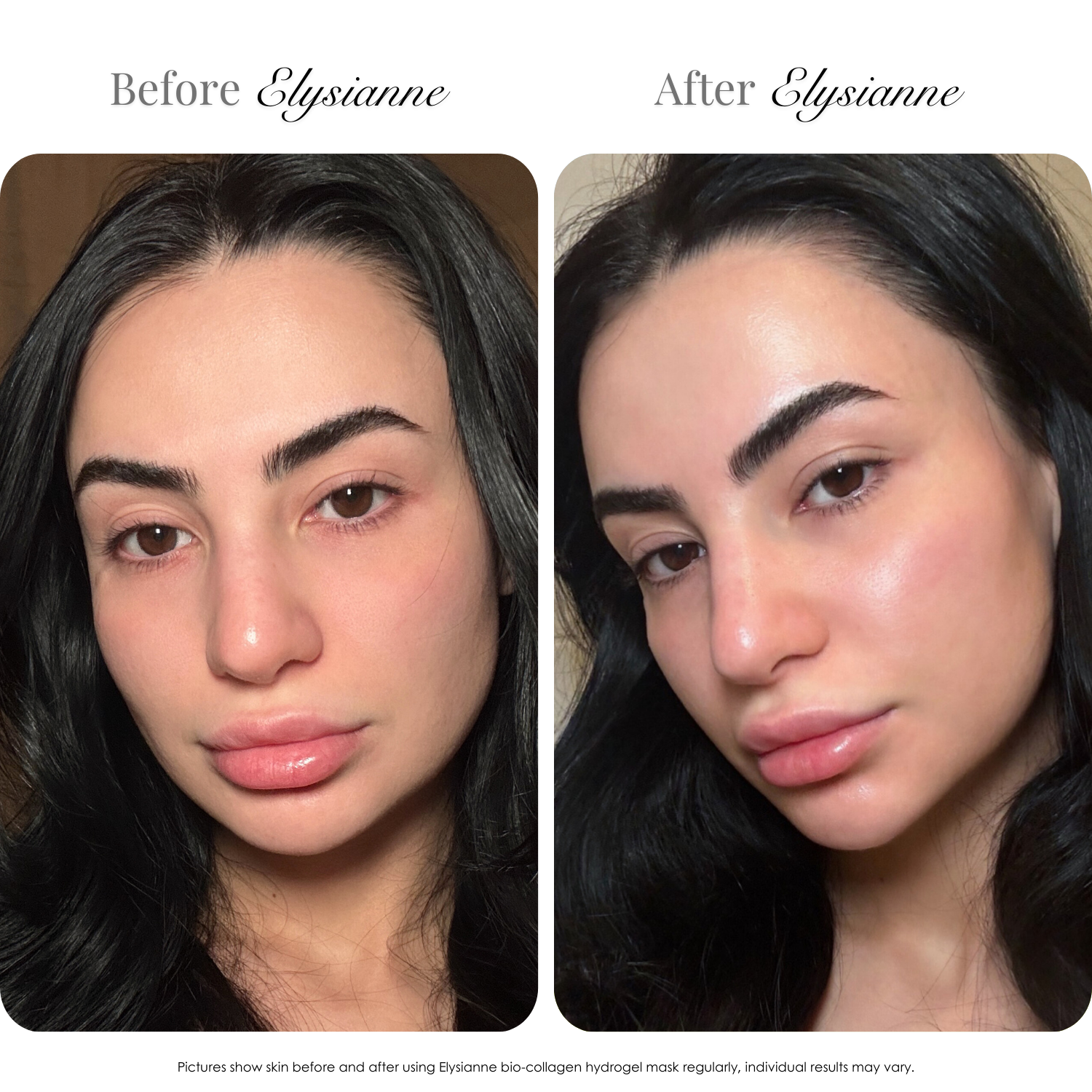 The Glow Set (2 organic collagen hydrogel masks + Éclat de Glace Gua Sha)