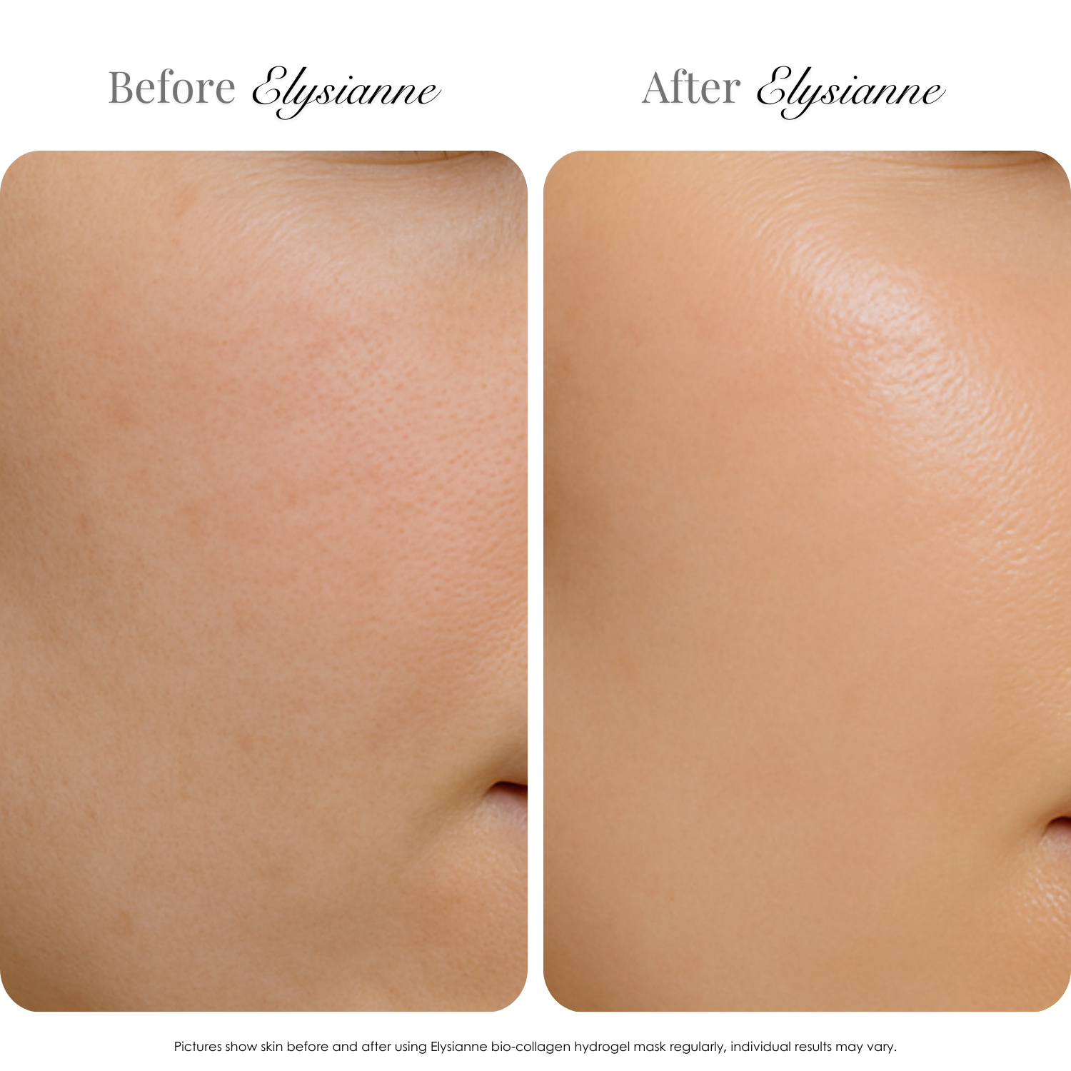 Bio-Collagen Hydrogel Mask