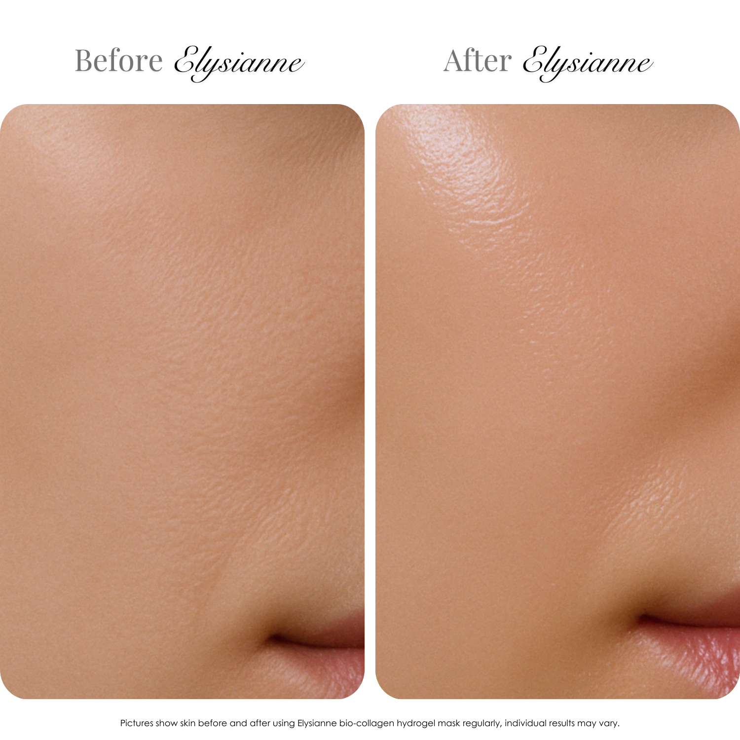 Bio-Collagen Hydrogel Mask