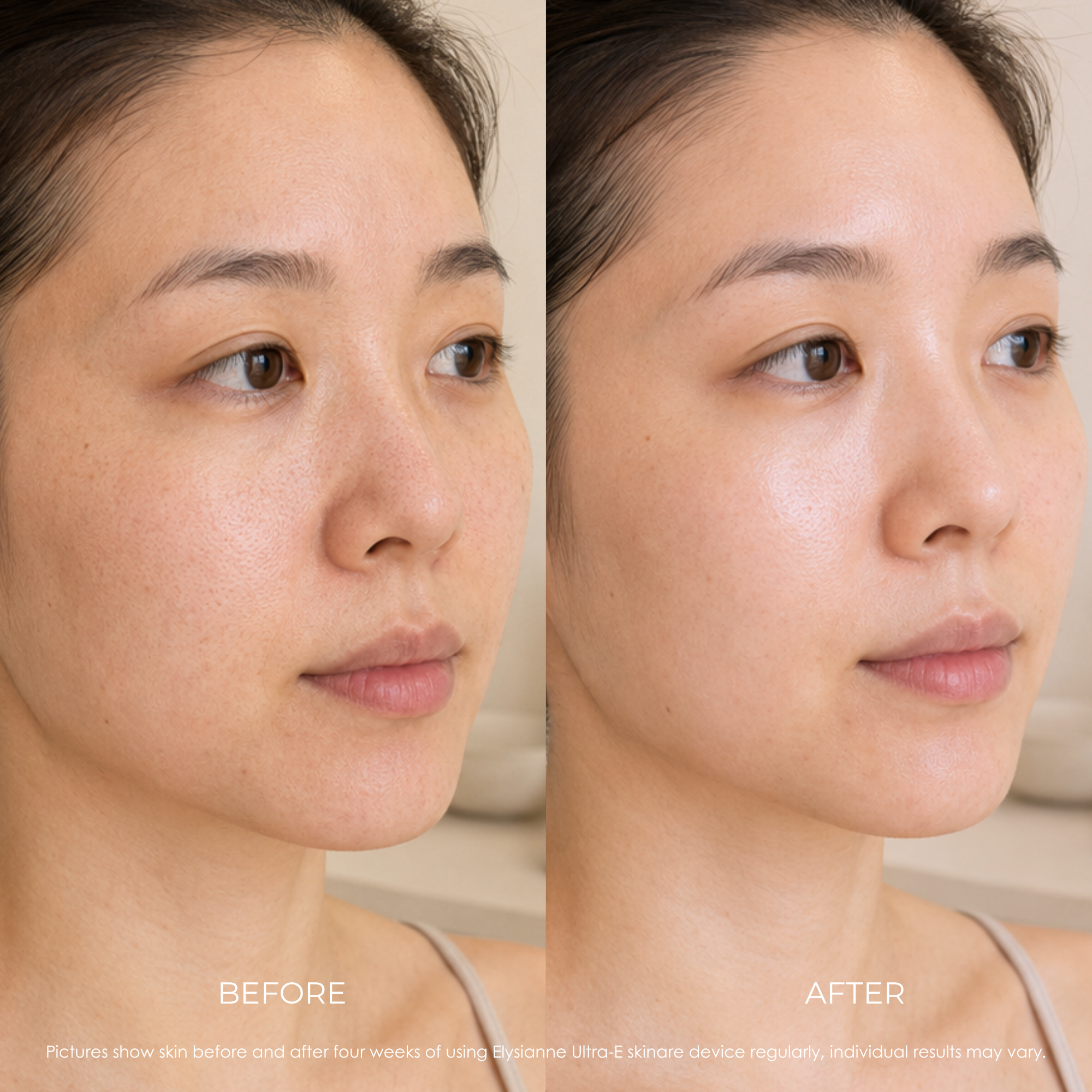 Elysianne Ultra-E Glow Wand