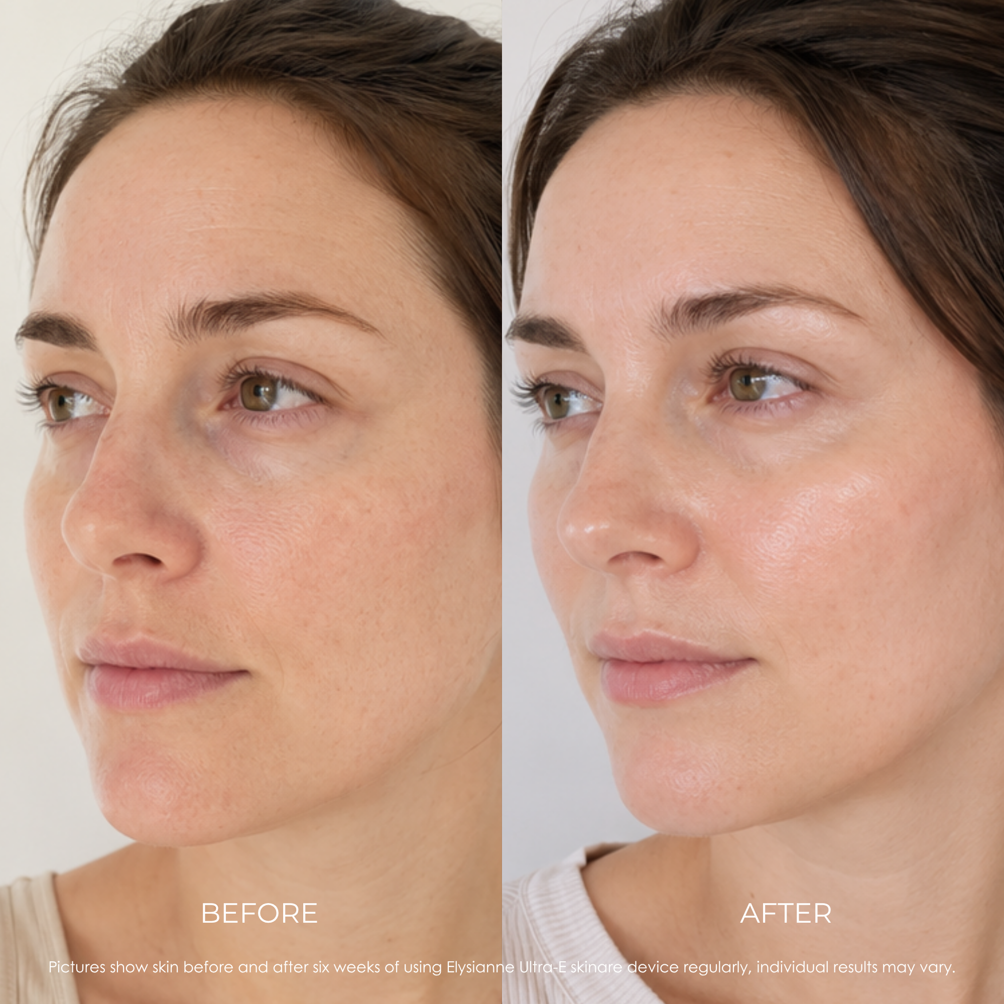 Elysianne Ultra-E Glow Wand